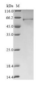 SDS-PAGE (DEK-5902H).jpg